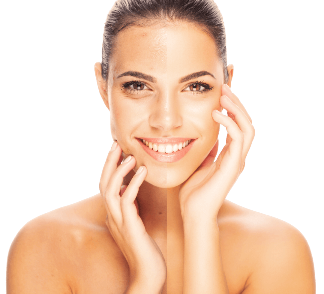 Skin Treatment Before and After