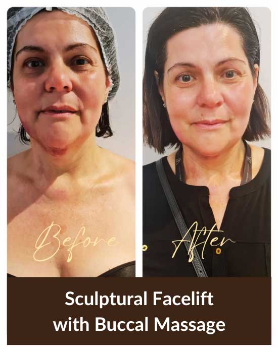 An-Experience-Beauty-Clinic-Buccal-Massage-(1)