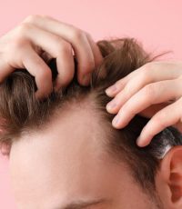 Hairloss treatment Hairloss treatment in Melbourne CBD