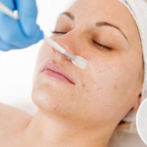 Skin treatment enzymatic peel